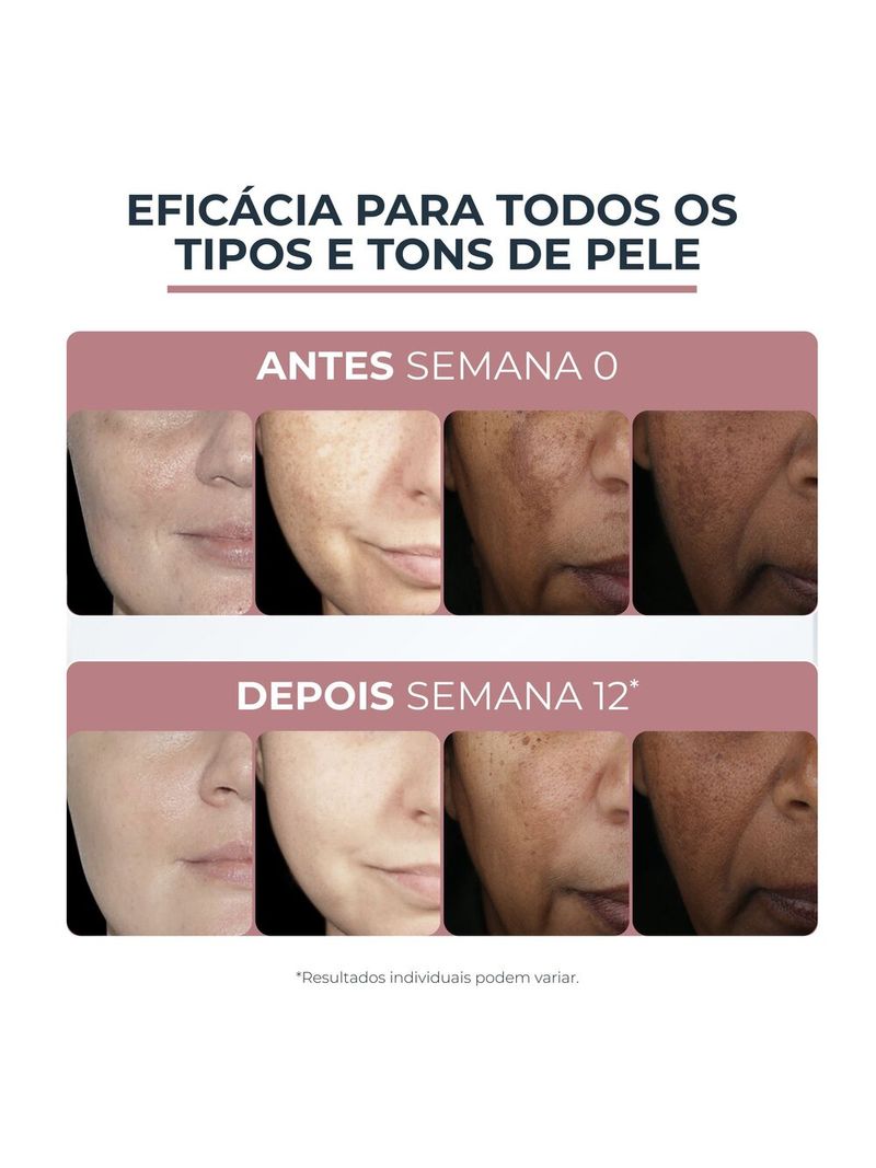 4005900559500-Eucerin_Anti_pigment_Clareador_Creme_Facial_Dia_FPS_30_50ml-Face-Eucerin_--6-.jpg