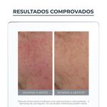 4006000045832-Eucerin_Antiredness_Fluido_Neutralizante_Tinted_FPS25_50ml-Face-Eucerin_--5-.jpg