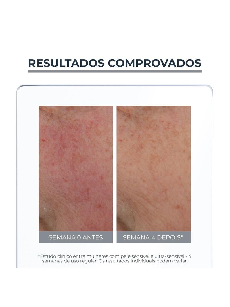 4006000045832-Eucerin_Antiredness_Fluido_Neutralizante_Tinted_FPS25_50ml-Face-Eucerin_--5-.jpg